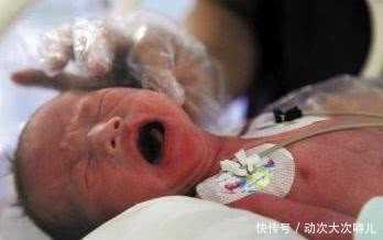 广州代生套餐_婴儿试管详细步骤:广州治疗输卵管堵塞价格